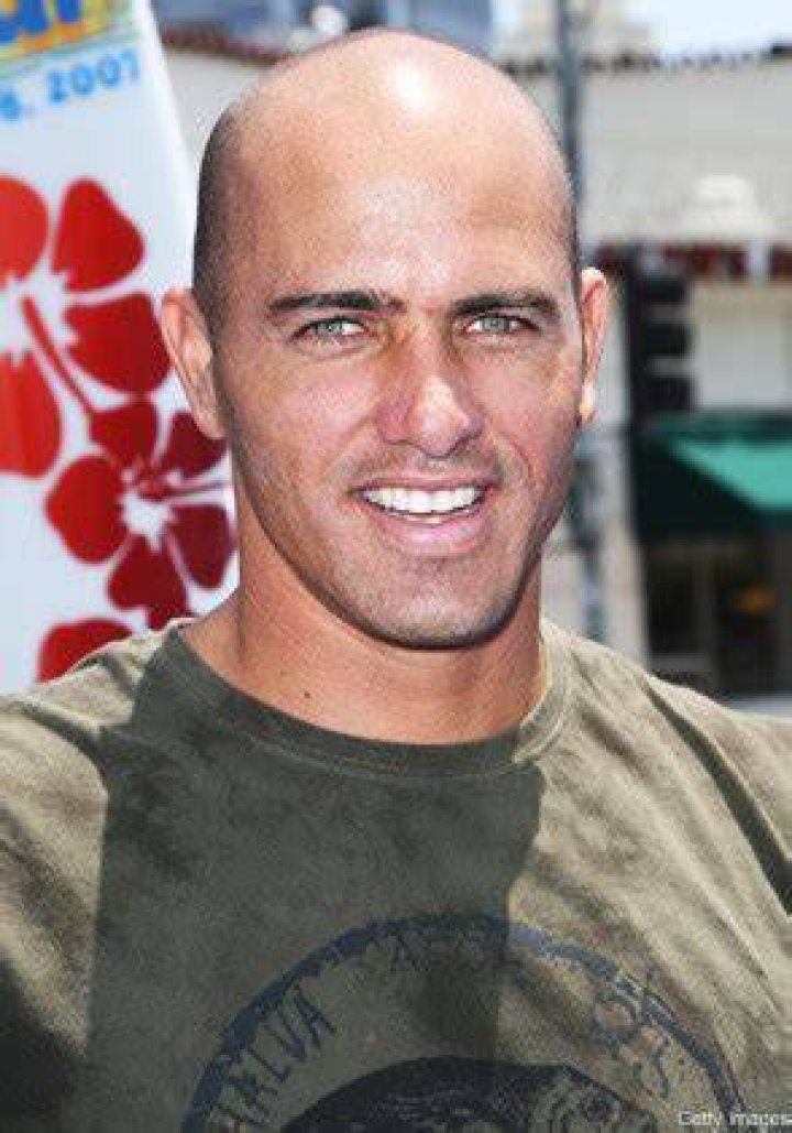 Going, Going, Gone! Outing Bald Celebrities Calum Best!